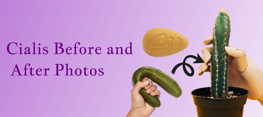 Cialis Before and After Photos