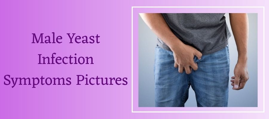 Male Yeast Infection Symptoms Pictures